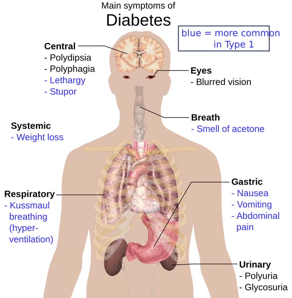 Symptoms of diabetes